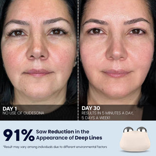 Glidesona by Glidelif microcurrent facial toning device, Nuface alternative, Results, After Before