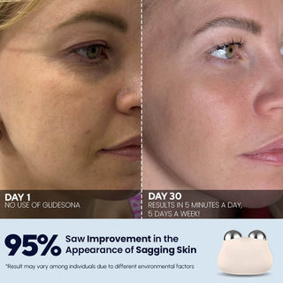 Glidesona by Glidelif microcurrent facial toning device, Foreo Bear alternative, Results, After Before