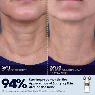 3-in-1 beauty device TriEssence by Glidelif - EMS, Microcurrent, LED functions