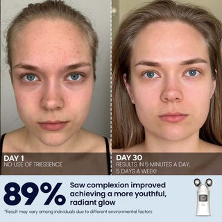 TriEssence facial rejuvenation device - EMS, Microcurrent, and LED technology, Results, After Before