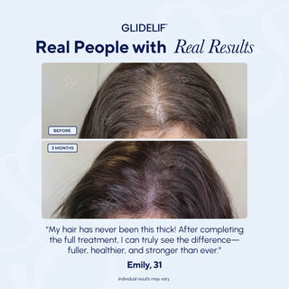 Before and after comparison of hair thickness with Glidelif branding and customer testimonial.