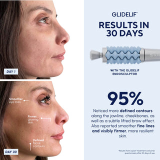 Glidelif EndoSculptor endospheres lymphatic massage at Home 