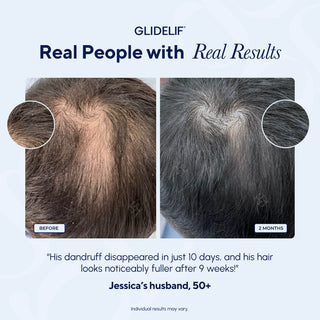 LumiGlide Hair Growth Brush