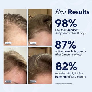 LumiGlide Hair Growth Brush