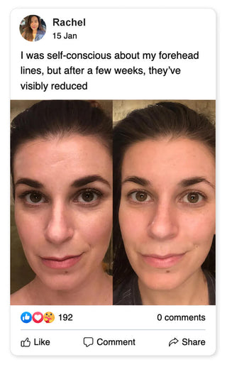 Before and after comparison of a woman's forehead, facebook review about Glidelif Multi-Sculpt Wand