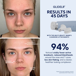 Glidelif Multi-Sculpt Wand, After Before Result
